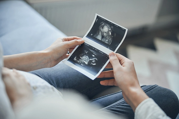 When Can I Take a 4D Baby Ultrasound and How to Choose a Pregnancy Ultrasound Clinic Near Me?